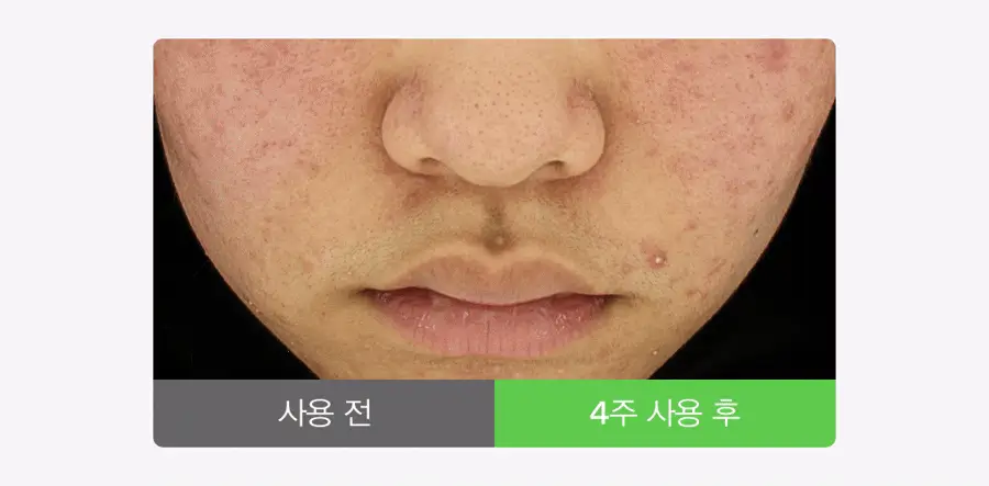 [어워즈한정기획/150매] 아비브 어성초 흔적 에센스 패드 클리어터치 70매 어워즈 기획 (+리필 70매+패드 10매) 상세페이지 14